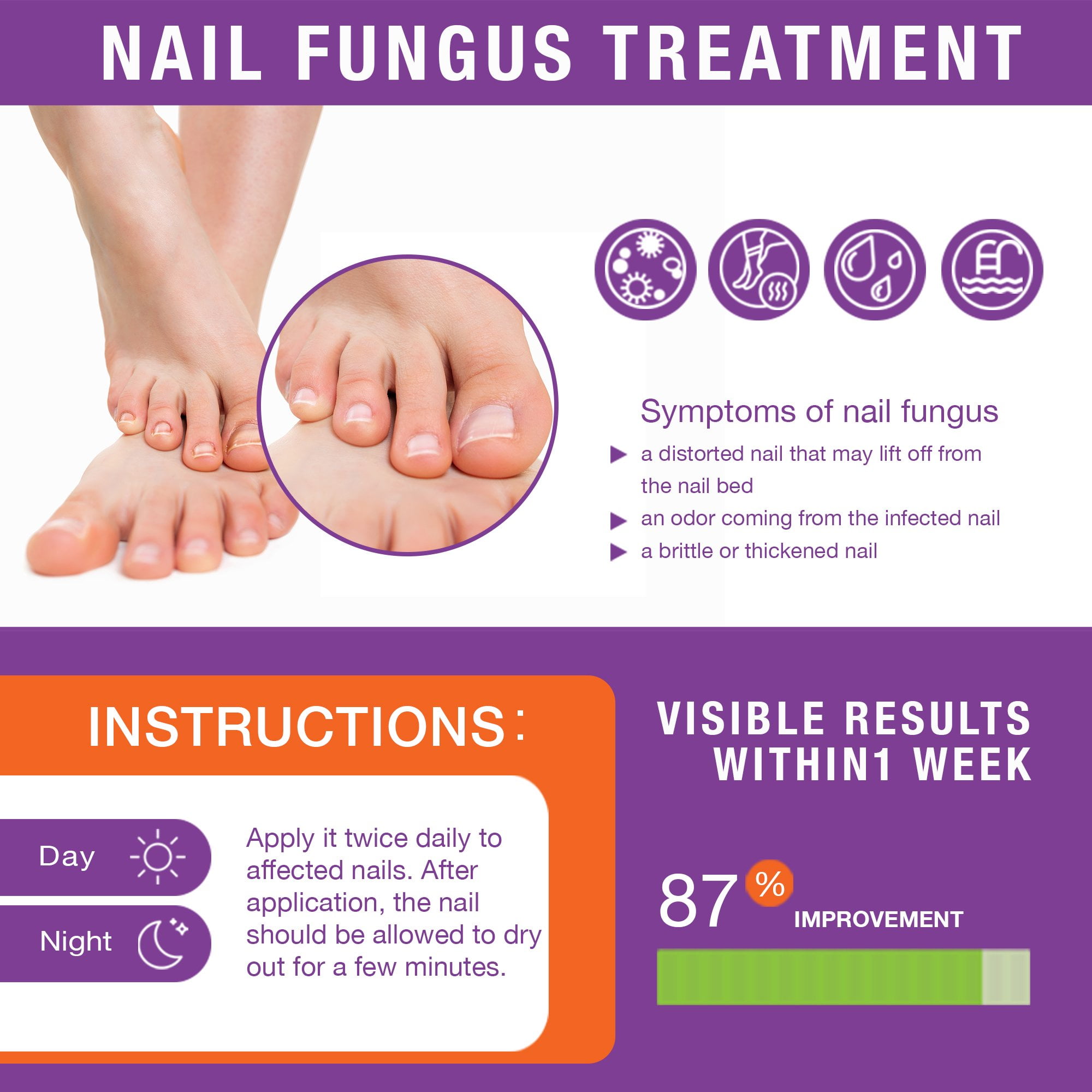 Best Ways to Treat a Nail Fungus | University of Utah Health